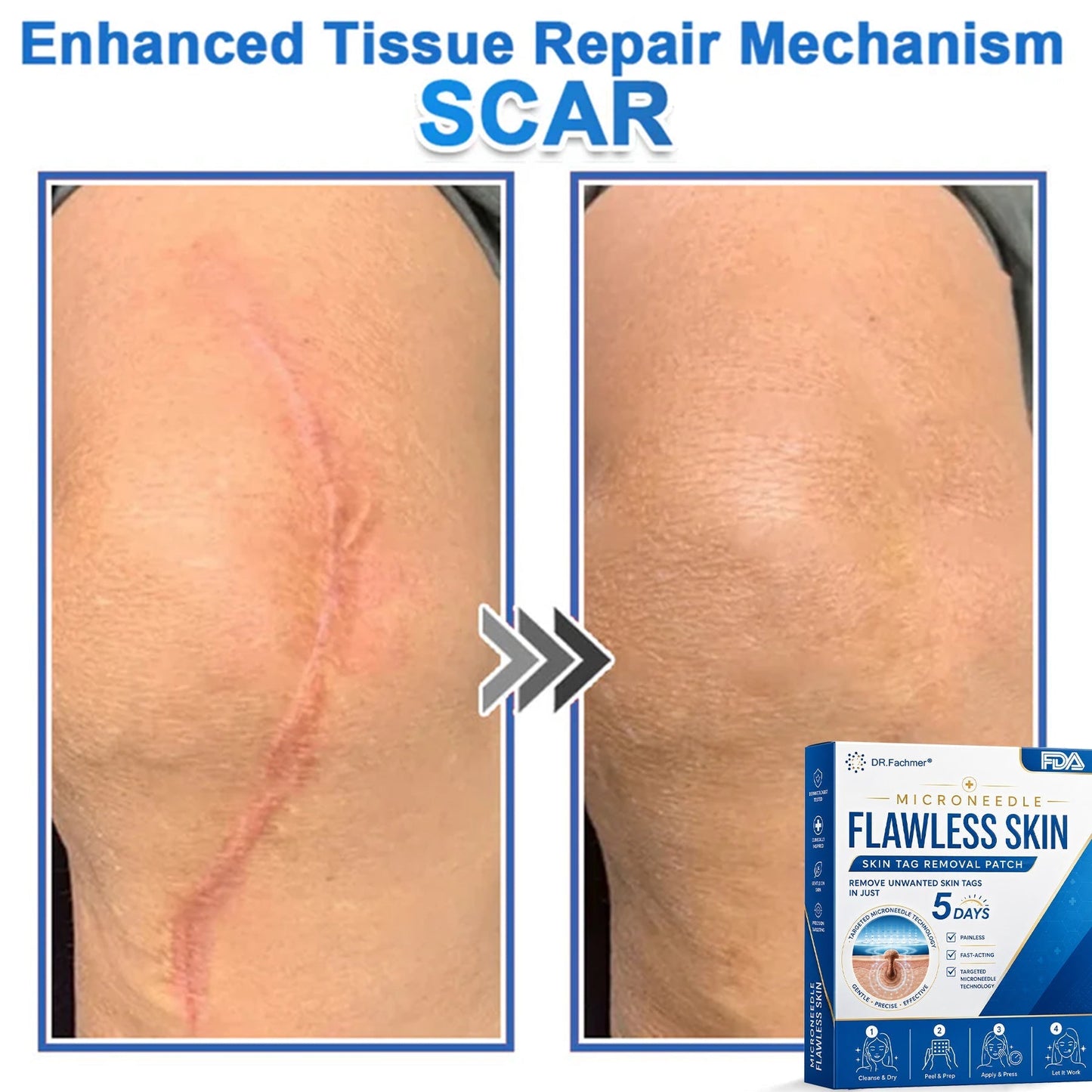 ✅ DR.Fachmer® 2-in-1 Microneedle & Hydrocolloid Patch | Raised Moles,Acne, Flat Warts & Skin Tags Remover | Improves Wrinkles, Scars & Blemishes | Invisible Pimple Patches for Face & Body
