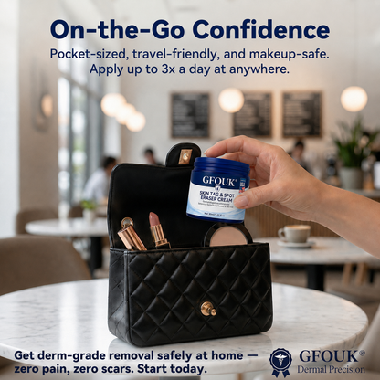 GFOUK® 7-𝐃𝐚𝐲 𝐒𝐤𝐢𝐧 𝐓𝐚𝐠 & 𝐒𝐩𝐨𝐭 𝐄𝐫𝐚𝐬𝐞𝐫 𝐂𝐫𝐞𝐚𝐦 (Zero Pain, Zero 𝐒𝐜𝐚𝐫𝐬 Formula) 🌹