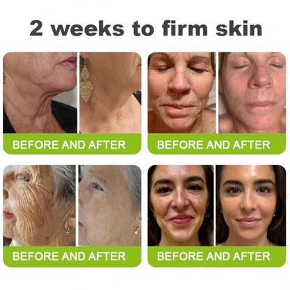 Dr. Fachmer®👩‍⚕️ Peptide Collagen INSTANT TIGHTENING + PEPTIDE FIRMING CARE, Instantly smooths puffiness and lines while supporting firmer skin with continued use