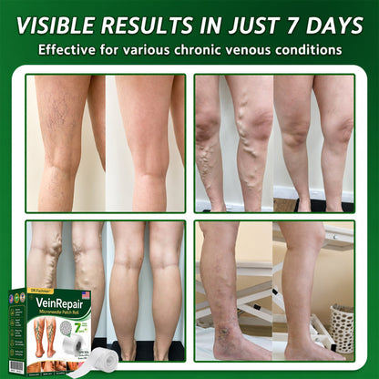🌿DR.Fachmer® Vein Ease Microneedle Care Patch (For Spider Veins, Varicose Veins, Swelling & Leg Fatigue) - Last Day Promotion 50% OFF
