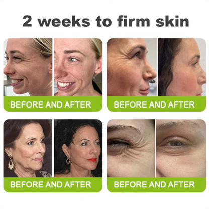 Dr. Fachmer®👩‍⚕️ Peptide Collagen INSTANT TIGHTENING + PEPTIDE FIRMING CARE, Instantly smooths puffiness and lines while supporting firmer skin with continued use