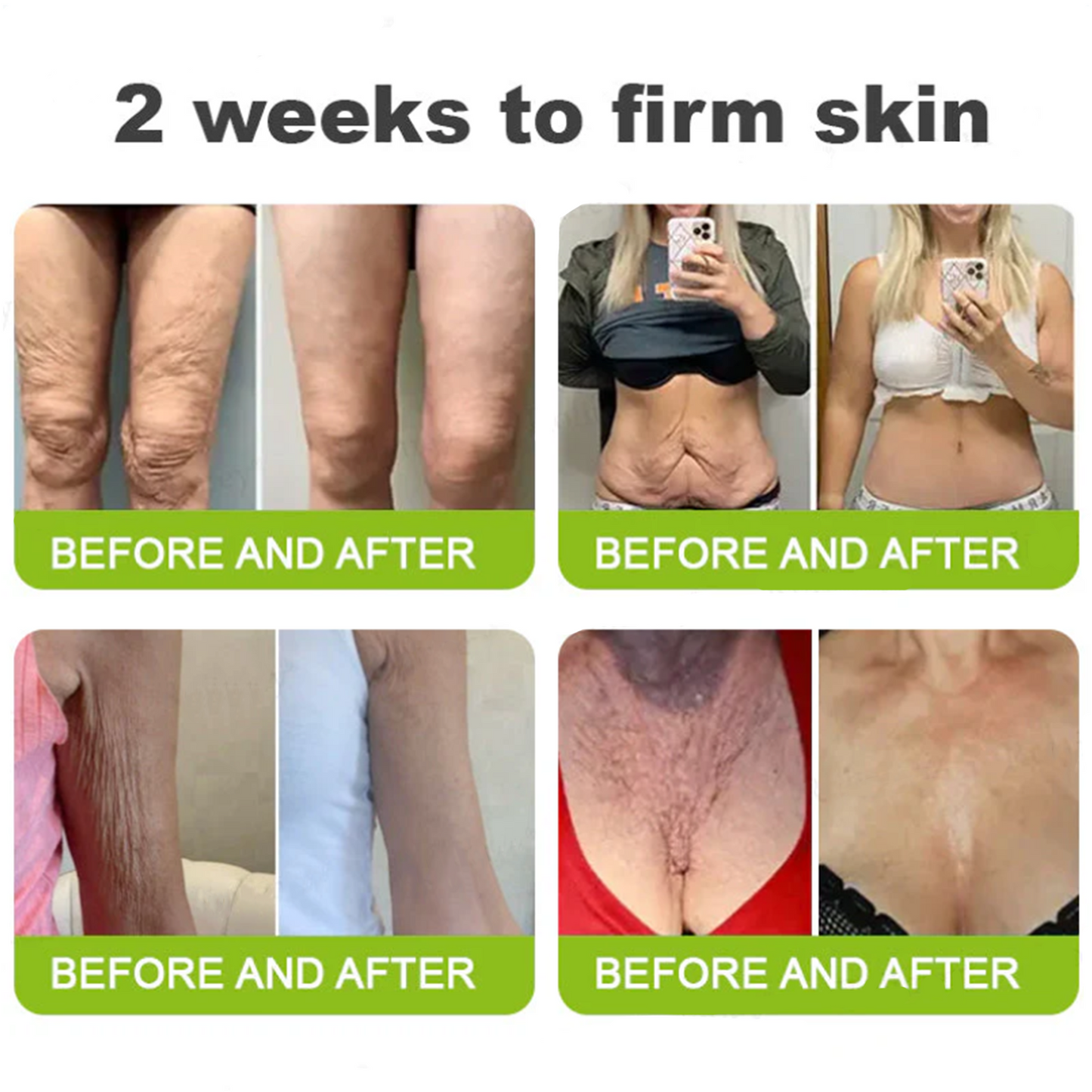 Dr. Fachmer®👩‍⚕️ Peptide Collagen INSTANT TIGHTENING + PEPTIDE FIRMING CARE, Instantly smooths puffiness and lines while supporting firmer skin with continued use