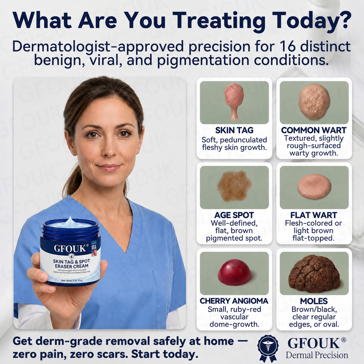 GFOUK® 7-𝐃𝐚𝐲 𝐒𝐤𝐢𝐧 𝐓𝐚𝐠 & 𝐒𝐩𝐨𝐭 𝐄𝐫𝐚𝐬𝐞𝐫 𝐂𝐫𝐞𝐚𝐦 (Zero Pain, Zero 𝐒𝐜𝐚𝐫𝐬 Formula) 🌹