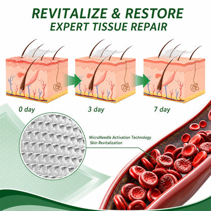 🌿DR.Fachmer® Vein Ease Microneedle Care Patch (For Spider Veins, Varicose Veins, Swelling & Leg Fatigue) - Last Day Promotion 50% OFF