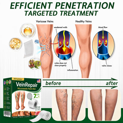 🌿DR.Fachmer® Vein Ease Microneedle Care Patch (For Spider Veins, Varicose Veins, Swelling & Leg Fatigue) - Last Day Promotion 50% OFF
