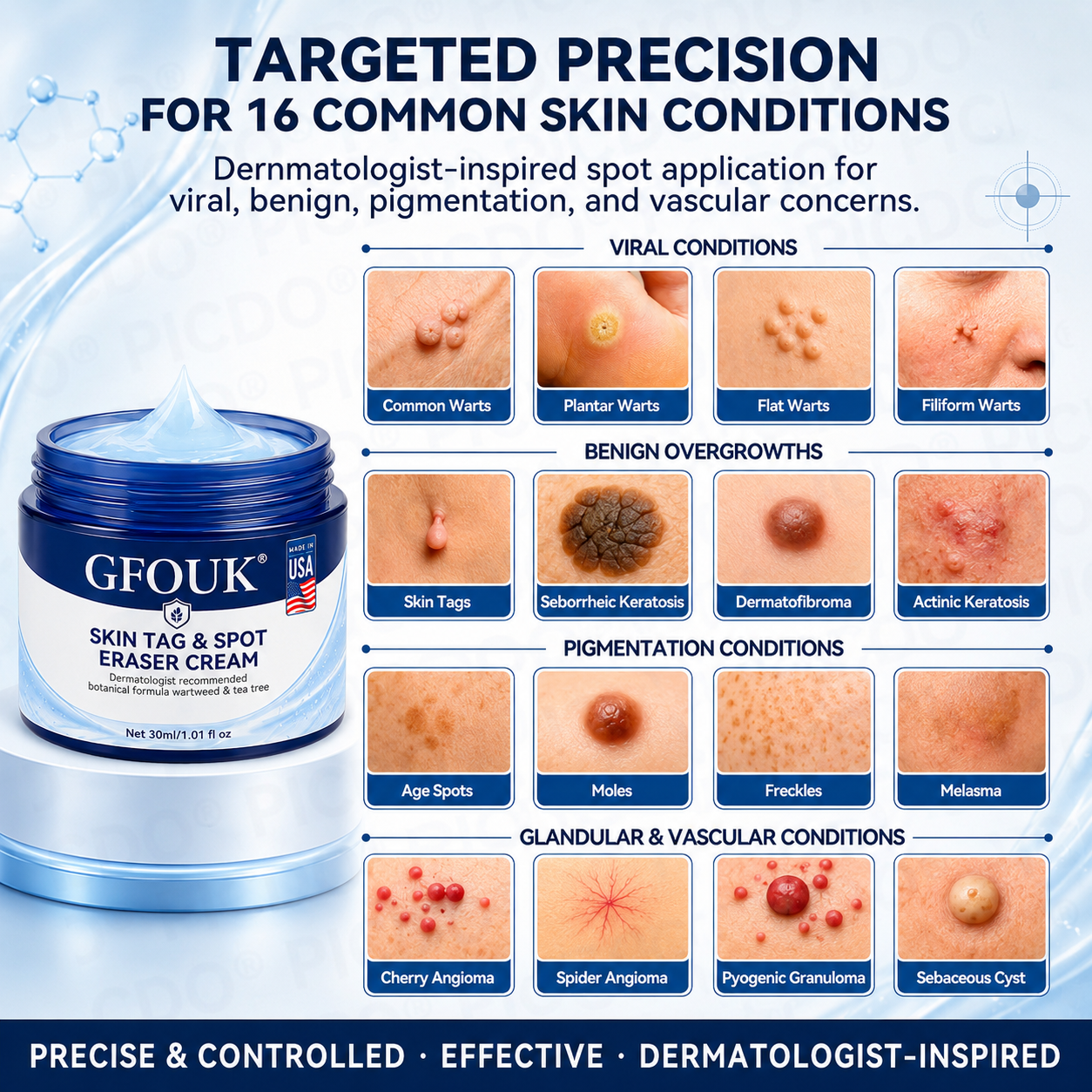 GFOUK® 7-𝐃𝐚𝐲 𝐒𝐤𝐢𝐧 𝐓𝐚𝐠 & 𝐒𝐩𝐨𝐭 𝐄𝐫𝐚𝐬𝐞𝐫 𝐂𝐫𝐞𝐚𝐦 (Zero Pain, Zero 𝐒𝐜𝐚𝐫𝐬 Formula) 🌹